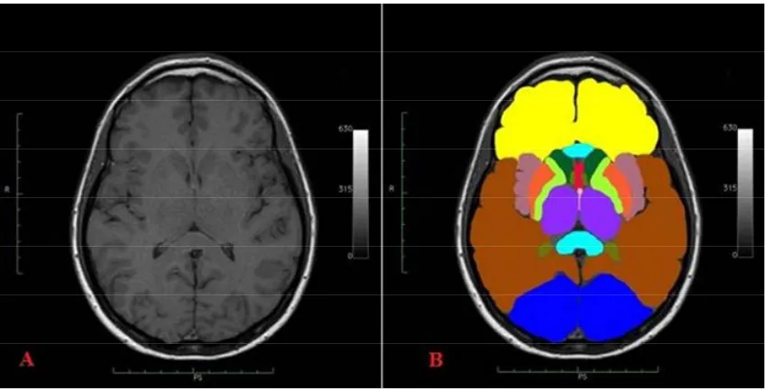 Figure 1. Manual segmentation of all anatomical structures. 