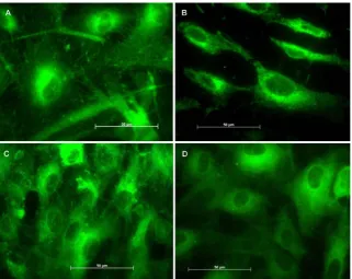 Figure 6hours, (B) 7 days and (C) 14 days and to control surface (D)Images of the immunohistochemical assays: α5β1 integrin expression on endothelial cells attached to titanium after (A) 24 Images of the immunohistochemical assays: α5β1 integrin expression on endothelial cells attached to titanium after (A) 24 hours, (B) 7 days and (C) 14 days and to control surface (D).