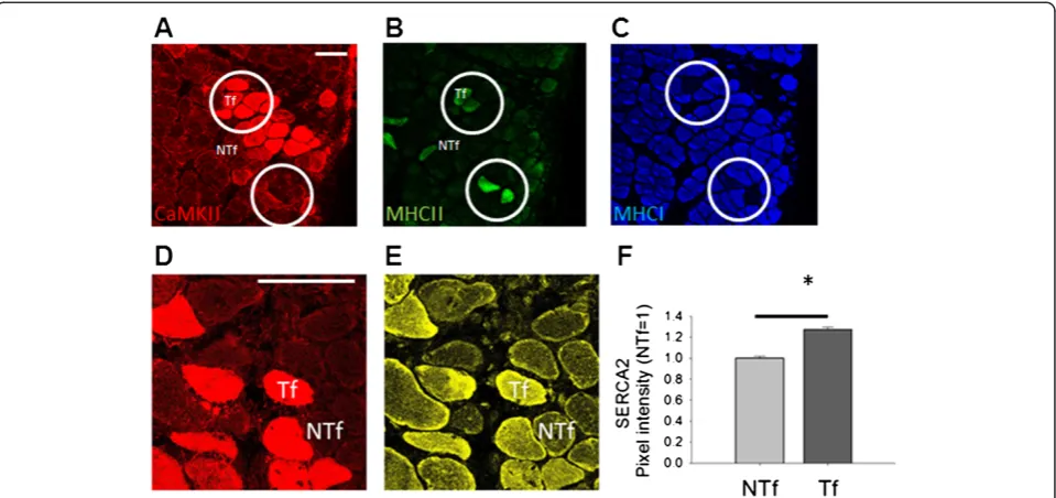 Figure 4 α/β CaMKII co-overexpression in relation to MHC and SERCA2 expression. A-C) Microscopic field of α/β CaMKII-transfected SOLmuscle stained for CaMKII (A, red), fast MyHCII (B, green) and slow MHCI (C, blue)