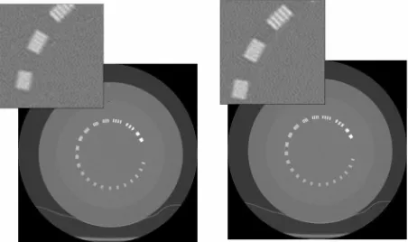 Figure 14. MTF analysis confirmed the small loss in limiting spatial resolution resulting in blurring of the bead
