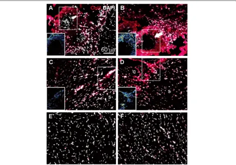 Figure 4 Collagen I expression in cardiac tissues of fish reared at normal and elevated temperature.expressed in larger structures resembling connective tissue of the compact (c) but not in the spongy (s) myocardium.myocardium show weak staining at both te