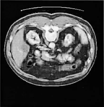 Figure 1: GA Results - Abdominal 1 image (control image)