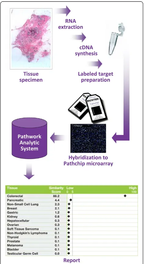 Figure 1 Tissue of Origin Test workflow and results. RNA fromfrozen tissue is extracted, amplified, and biotin-labeled beforehybridization to a Pathchip™ microarray
