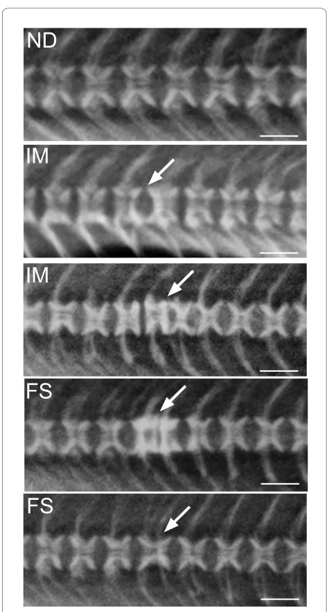Figure 2 X-ray and diagnostics. The development of vertebral fu-sions is a dynamic process where the final result is a complete fusion of two or more vertebral bodies