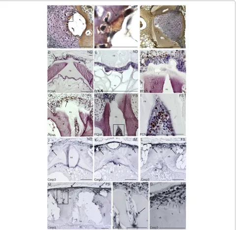 Figure 4 Immunohistochemistry with TRAP, PCNA and Caspase 3observed ectopic bone formation (arrow)