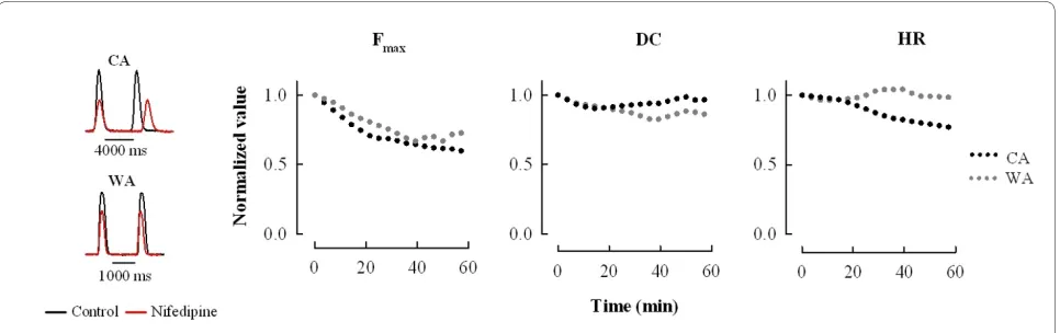 Figure 5 Inhibition of Iusing the whole-cell patch-clamp. (Left) A representative recording showing concentration-dependent inhibition of I(R) of ICa by CCh