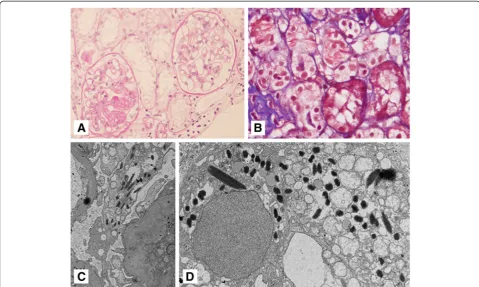 Fig. 1 a Some glomeruli show segmental or global glomerulosclerosis (periodic acid–Schiff stain, ×400 magnification)