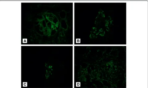 Fig. 2 Immunofluorescence microscopy of the glomerulus.complement component C3 (++), C1q (+), and for fibrinogen (trace) ( a A linear pattern for IgG (trace) (x200 magnification)