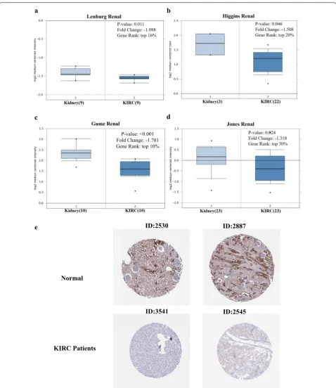 Fig. 1 Expression of EPB41L1 in human KIRC. Box plot showing fold change and associated p values based on Oncomine analysis of EPB41L1 levels, respectively in the Lenburg Renal, Higgins Renal, Gumz Renal, and Jones Renal (a–d)