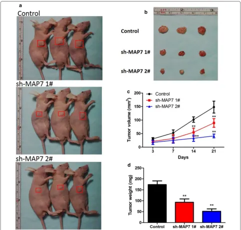 Fig. 9 The effect of MAP7 on the growth of CC tumors were detected in mice model in vivo