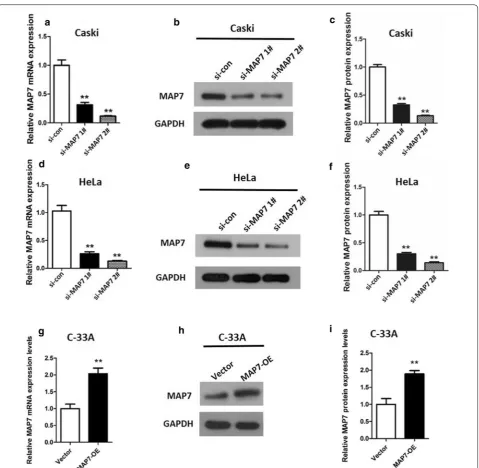 Fig. 2 MAP7 expression in CC cells transfected with si‑MAP7 1#/2# or MAP7‑OE. a mRNA and b, c protein expression of MAP7 in Caski cells; d mRNA and e, f protein expression of MAP7 in HeLa cells 24 h after transfection with si‑MAP7 1#/2#; and g mRNA and h, 