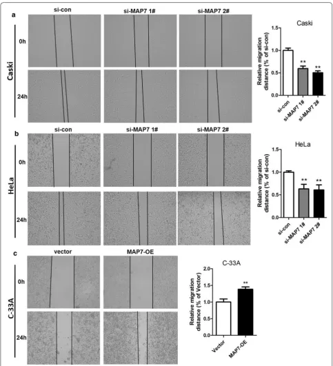Fig. 4 Scratch assay was conducted to detect the migratory ability of Caski and HeLa cells transfected with si‑MAP7 1# or 2# and C‑33A cells transfected with MAP7‑OE