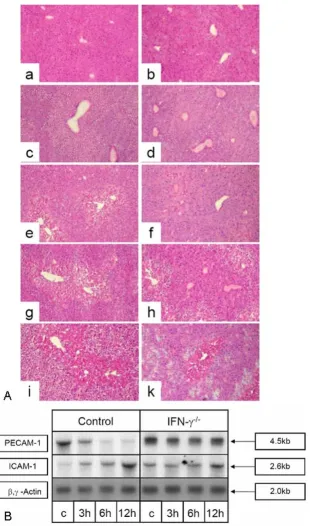 Figure 7(A) HE staining of liver sections of C57BL/6 mice (a, c, e, g, i) and B6ers and reduced increase of the ICAM-1 specific transcript level