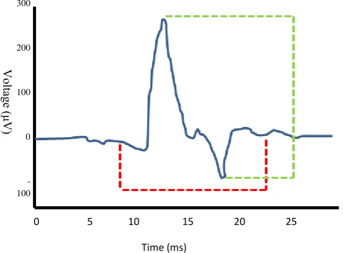 Figure 4: EMG features which can be measured within a motor unit action potential 