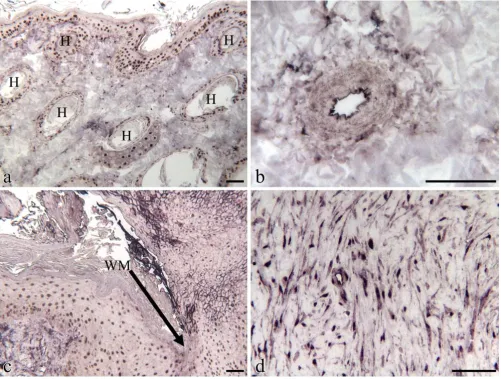 Figure 3Immunohistochemical localization of β-catenin in the epidermal compartment of equine skin or woundsImmunohistochemical localization of β-catenin in the epidermal compartment of equine skin or wounds
