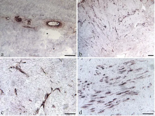 Figure 4Immunohistochemical localization of PECAM1 in the dermal compartment of equine skin or wounds tissuesImmunohistochemical localization of PECAM1 in the dermal compartment of equine skin or wounds tissues