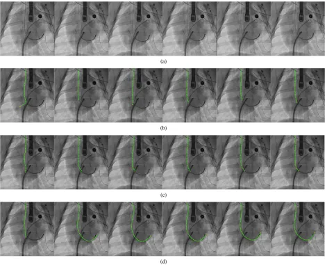 Fig. 8. Examples of the tracking result on porcine X-ray data. Rows (a), (b), (c), and (d) correspond to the original data, the results of growing extraction only,