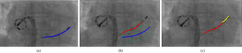 Fig. 3. Catheter tracking in X-ray. (a) An example of a previous frame in X-ray with the result of catheter extraction marked in blue
