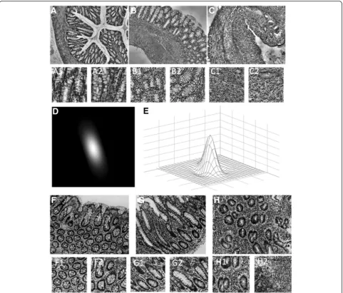 Fig. 1 Examples of typical analyzed images representing whole range of tissue patterns: healthy control (inflammation (a–mice; f–human) on the left; chronicb–mice; g–human) in the middle and acute inflammation (c–mice; h–human) in the right
