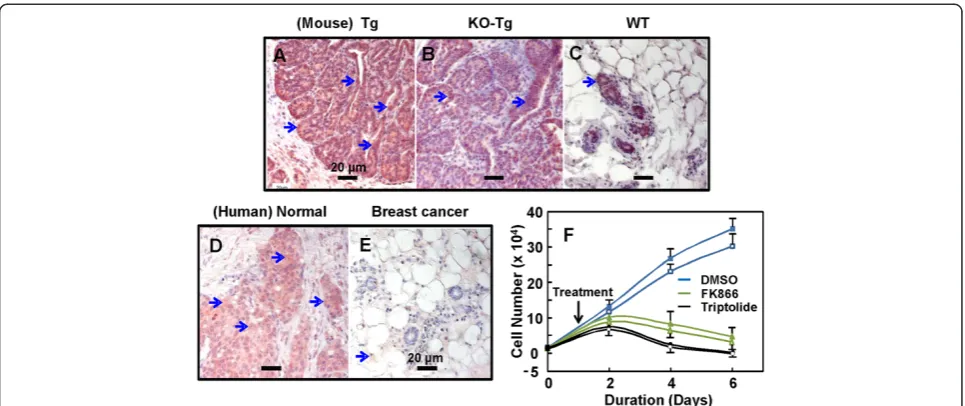 Figure 8 Inhibition of mammary tumor cell growth by targeting nicotinamide phosphoribosyltransferase (NAMPT).FK866, a catalytic inhibitor for NAMPT, significantly reduced the population growth of primary tumor cells Tissue sections frommouse breast tumor n