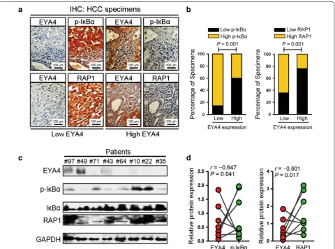 Fig. 6 Clinical relevance of EYA4 expression for the IκBα/RAP1 axis in human HCC tissues