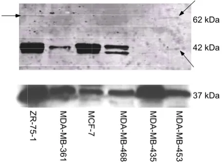 Figure 2tein in Figure 1 was GIRK1Immuno-precipitation to determine that the lower MW pro-Immuno-precipitation to determine that the lower MW protein in Figure 1 was GIRK1