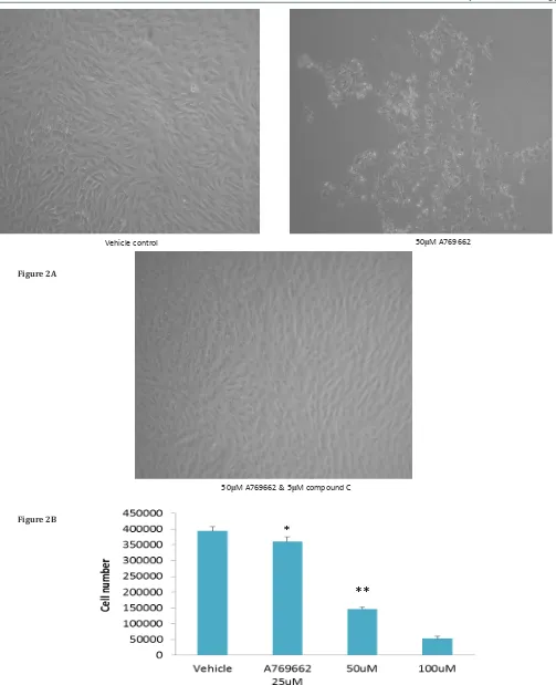 Figure 2A50μM A769662 & 5μM compound C * 