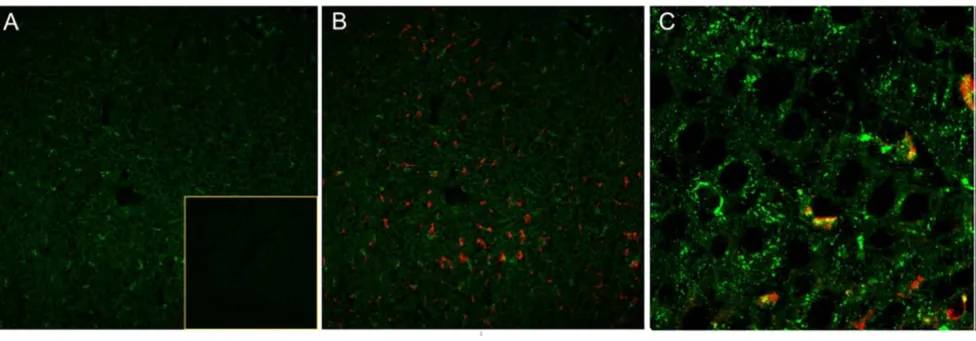 Figure 1Detection of endogenous LPL in rat liver by immunofluorescencebody ED2 (detected with Alexa 546-labeled goat anti-mouse antibodies (red))