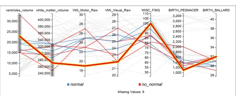 FIGURE 8 | Parallel coordinates display configured for searching possible PVL cases, lines that don’t match the filters on each axis are shown in gray.