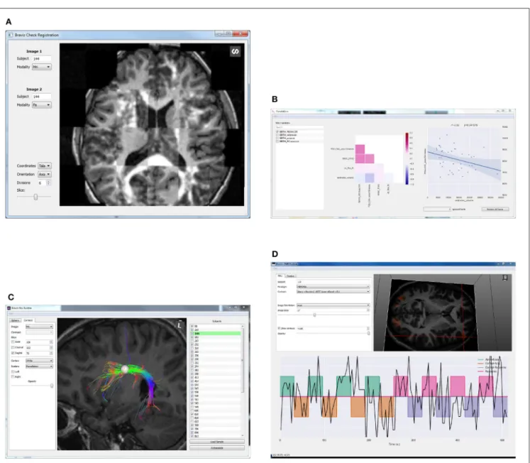 FIGURE 3 | Examples of BRAVIZ applications. (A) Check Registration, (B) Correlations, (C) ROI Builder, (D) FMRI Explorer.