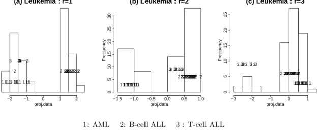 Figure 5. Leukemia data : 1-dimensional projection (p=40) (a) the histogram of the optimal projected data using I L 1