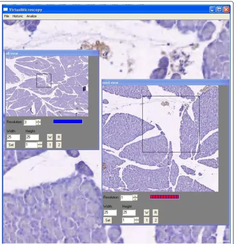 Figure 1 Graphical User Interface of the virtual microscope prototype. This illustration shows a small and medium microscope magnification forlower resolutions while a high enlargement is displayed in the large window