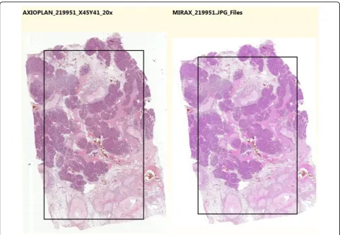 Figure 2 Automatically chosen common fragments of twovirtual slides. Fragments of the selected common areas of thevirtual slides are presented to the user