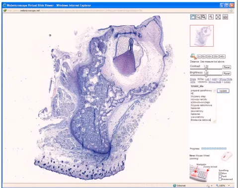 Figure 1 Screenshot of WebMicroscope plug-in viewer. This is screen shot of the WebMicroscope for the oral pathology course