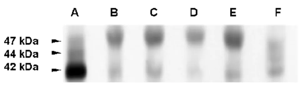 Figure 9Immunoblot analysis of cx43 protein expression in GL15 cell line 40 µg of total protein extracts from undifferentiatedand differentiated GL15 monolayers are electrophoresed and blotted according to Material and Methods