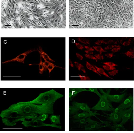 Figure 2GL15 phenotypes. Panels A and B represent, respectively, phase-contrast images of sub-confluent undifferentiated cells,grown in D-MEM containing 10% FCS, and differentiated cells incubated for 10 days in D-MEM supplemented with 2% HS