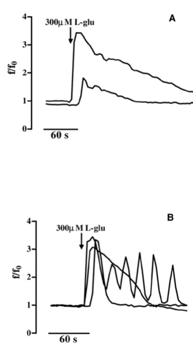 Figure 4Temporal analysis of [Caalthough with different amplitudes (A). In panel B the tracesrepresent the three equally probable [Ca2+]i variations induced by L-glutamic acid in GL15 phenotypes