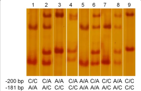 Figure 2 SSCP patterns of the EAAT2 promoter genotypes.Following PCR amplification, all samples were run on the same SSCPgel and then visualised