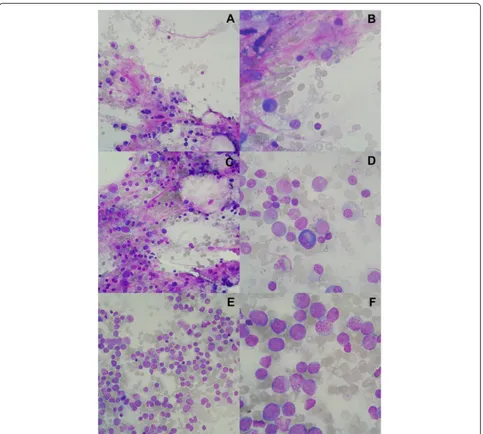 Fig. 1 Qualitative assessment of bone marrow aspirates on D14 induction chemotherapy in AML patients