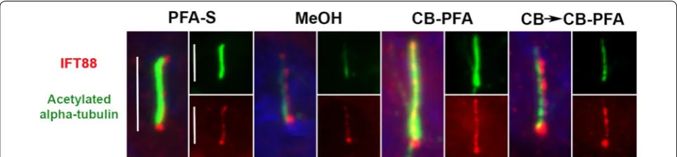 Fig. 5 Different fixation methods affect IFT88 immunolabeling at cilia in IMCD3 cells