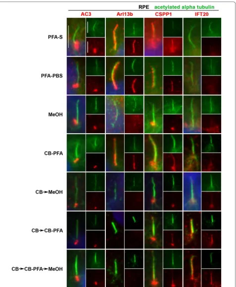 Fig. 6 Different fixation methods affect cilia marker immunolabeling in RPE cells. RPE cells were subjected to various fixation methods and then probed with AC3, Arl13b, CSPP1, and IFT20 antibodies (red)