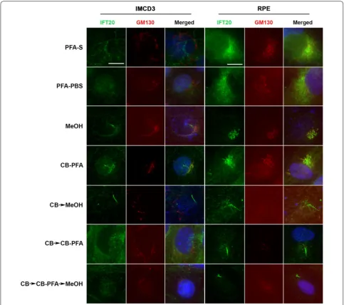 Fig. 8 Different fixation methods affect IFT20 labeling of cis-Golgi in IMCD3 and RPE cells