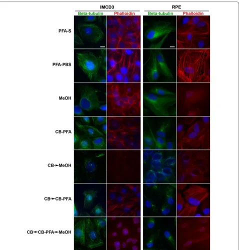 Fig. 1 Different fixation methods affect microtubule immunolabeling and phalloidin staining of actin stress fibers in IMCD3 and RPE cells