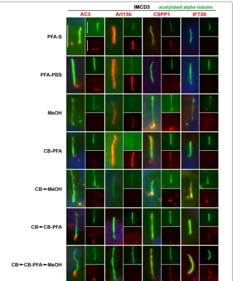 Fig. 4 Different fixation methods affect cilia marker immunolabeling in IMCD3 cells. IMCD3 cells were fixed with various fixation methods and then probed with AC3, Arl13b, CSPP1, and IFT20 antibodies (red)