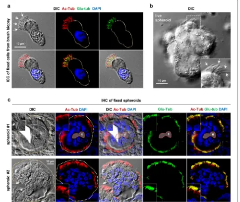 Fig. 1 Immunofluorescence microscopy analysis of 3D-E spheroids. a Immunocytochemical (ICC) analysis of a ciliated epithelial cell isolated from the nasal brush biopsy