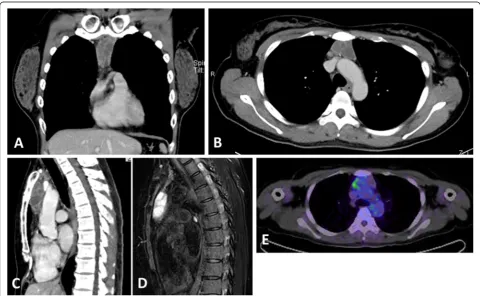 Fig. 1 Radiological imaging of the lesion. Contrast-enhancement computed tomography (CT) shows a tumor in the superior anterior mediastinumwith slightly enhanced multiple septa (a-c)