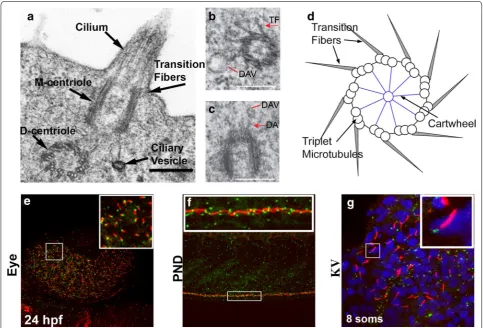 Fig. 1 a–d Zebrafish transmission electron micrographs highlighting conserved BB structures: nine-triplet microtubule arrangement, TF transi-tion fibers, DA distal appendages, DAV distal appendage vesicles