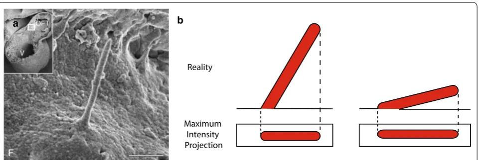 Fig. 1 Visual appearance of a primary cilium. a. Scanning Electron Microscopy image in the developing heart showed a continuous slope of the endothelial primary cilium