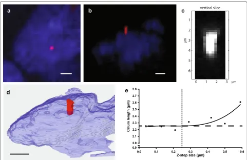 Fig. 2 Visual appearance of the same cilium with the different methods. Visual appearance of the same angled cilium with the MIP method (a), PyT method (b) (see also Additional file 4: Movie S2), DAAS method (c), and a reconstruction with Amira (d)