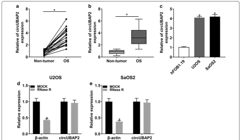 Fig. 1 circUBAP2 was significantly upregulated in OS tissues and cells. a, b The expression level of circUBAP2 in normal tissues and tumor tissues was detected by qRT-PCR